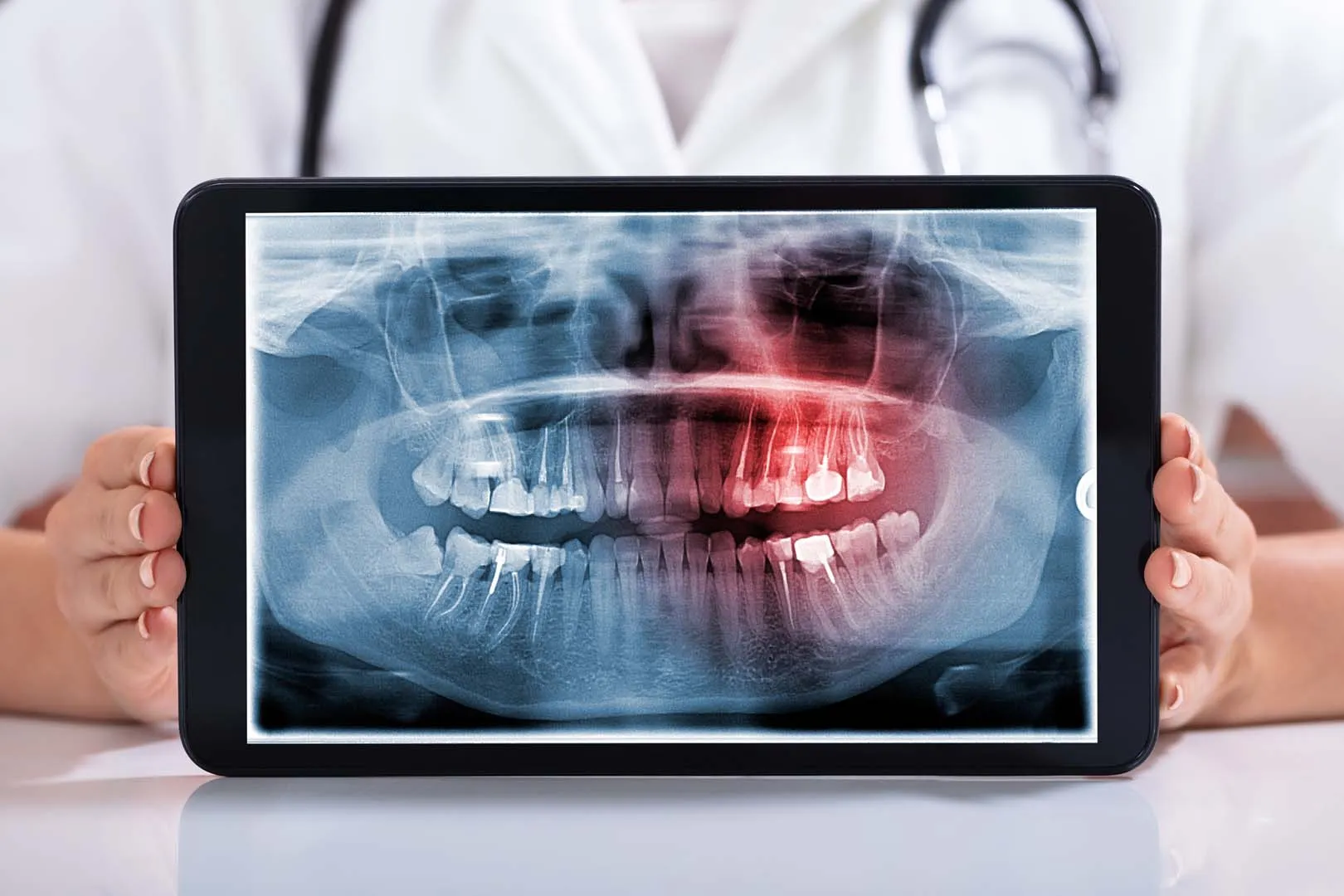 Dentist holding a tablet showing a panoramic dental X-ray with one area highlighted in red